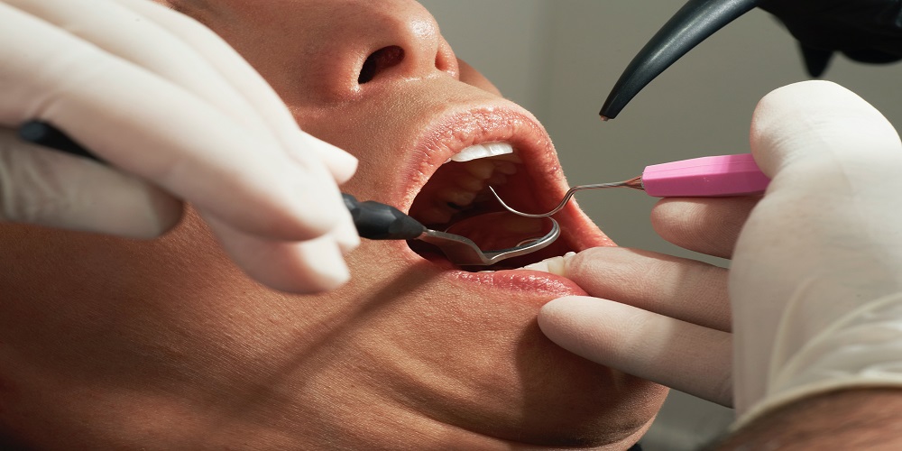 dental checkup